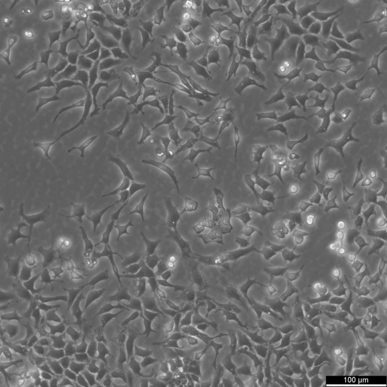 CHO Cells: Warum Sie in der Biopharmazeutischen Produktion Unverzichtbar Sind CHO Cells